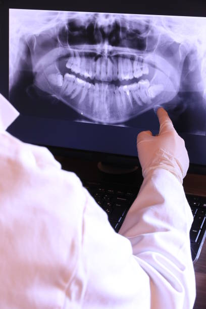 Best Root Canal Emergency Dentist  in Bogata, TX