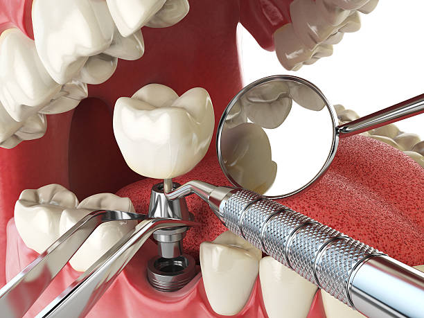Best Urgent Tooth Repair  in Bogata, TX